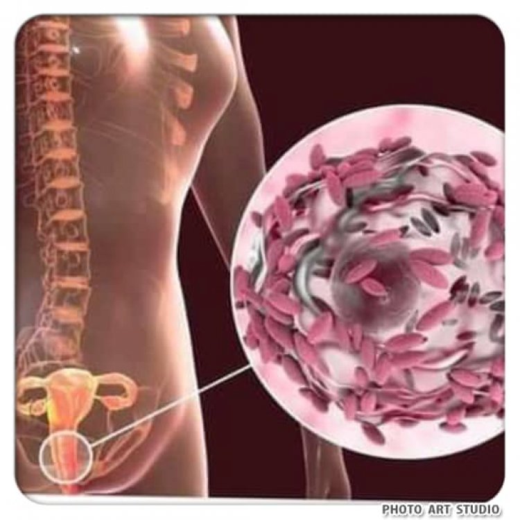 Bayani Kan Ciwon Mara Da Mata Ke Fama Da Shi