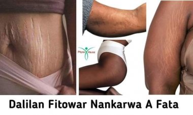 Daman ba iya mai juna biyu Tsagewar fatar ciki ke fitowa ba?