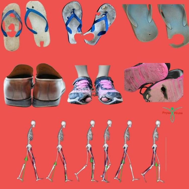 Ka san me takalminka ke cewa game da gaɓoɓin ƙafarka?