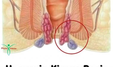 Hanyoyi Shida Domin Kiyaye Basir Cikin Sauƙi
