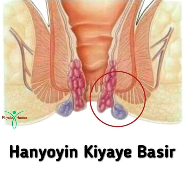 Hanyoyi Shida Domin Kiyaye Basir Cikin Sauƙi