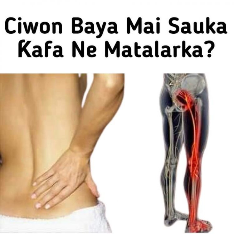 Ciwon Baya Mai Sauka Ƙafa Ne Matsalarka Kuma Ka Gaji Da Shan Magani?