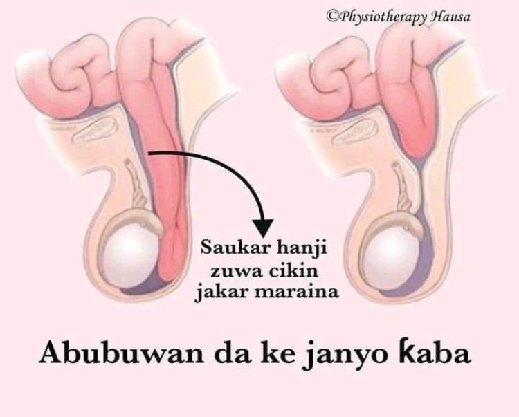 Ɗisowa ko ƙwacewar fitsari ce matsalarki/ka?