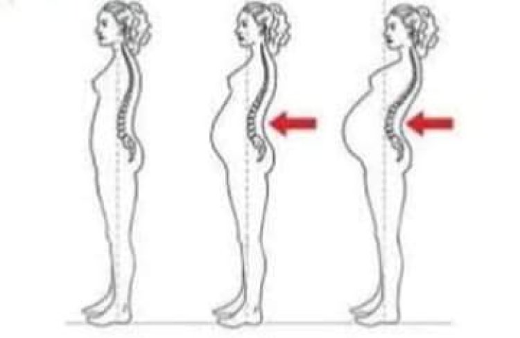 Dalilin Ciwon Baya Yayin Goyon Juna Biyu